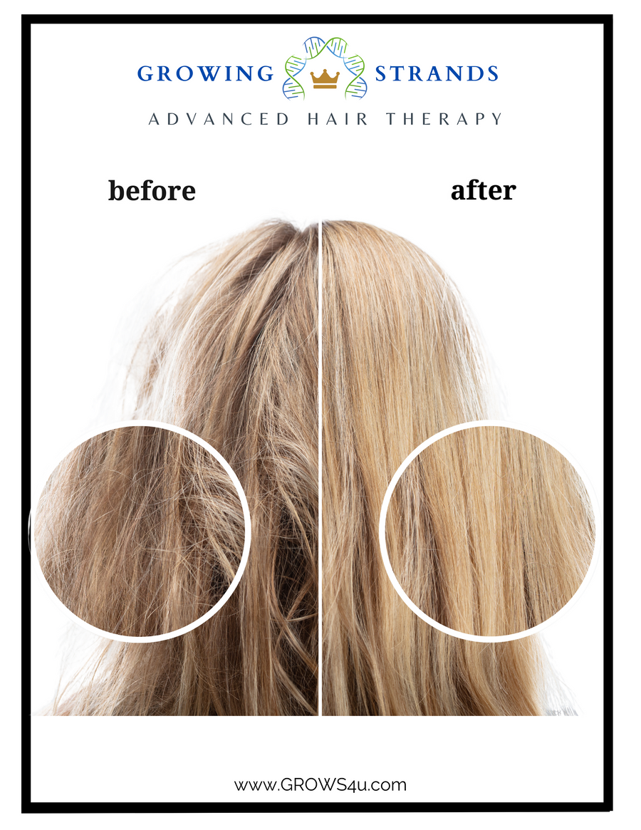 Scalp Spray