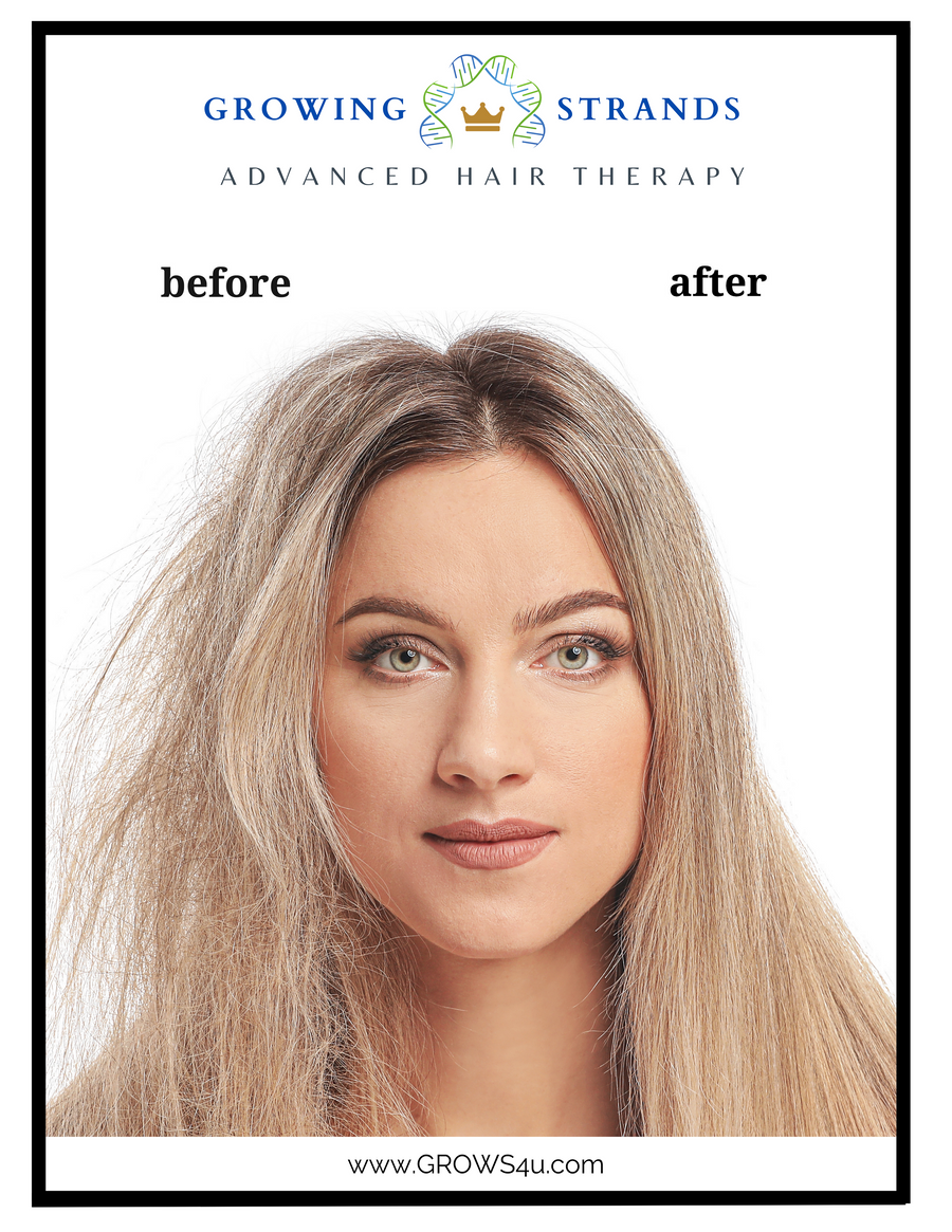 Scalp Spray